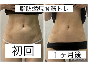 エクラ(Eclat)/Eclatの痩身★before/after17