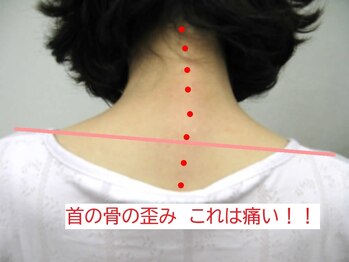 エスコート芦屋サロン/40代 女性 首痛