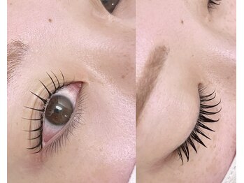 ララ(RARA)/アンドヘルシー100本¥8300