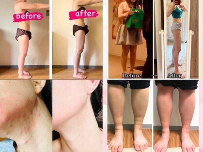 ヨサパーク マヒナ(YOSA PARK Mahina)の写真