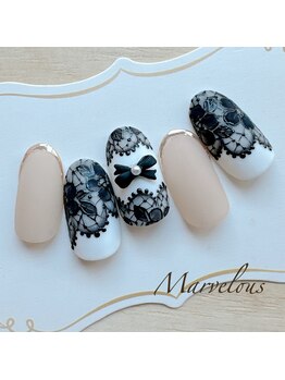 マーヴェラス 大宮店(Marvelous)/ブラック★レース