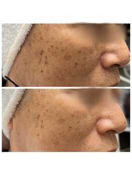 エターナル(Eternal)/これは嬉しい☆