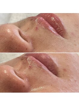 レアファースト/フェイスワックス