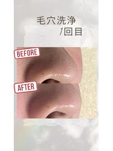 ビオラ(viola)/大人気「毛穴洗浄」♪