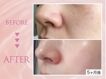 クリアラボ 池袋2nd(Clear Lab)/韓国肌管理&毛穴洗浄専門店