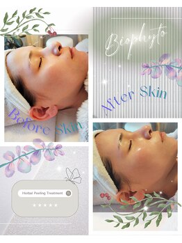 ハレル(Hareru)/Before…After(8)　BIOPHYTO