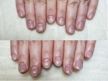 深爪矯正 爪悩み専門店 グラシナ 西宮北口店【4/3 NEW OPEN（予定）】/(深爪/長さだし/フィルイン)