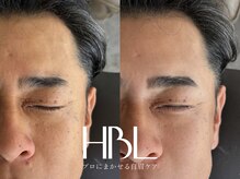 ラトリエ(L'Atelier)/HBL｜before/after