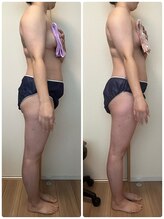 ローズ 下松(ROSE)/【筋膜リリース1回の変化】150分