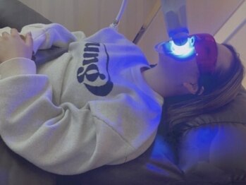 スピカ(spica)の写真/≪独自開発・高性能ジェル使用≫セルフホワイトニングで輝く白い歯に★気軽に通えて効果◎憧れの白い歯へ♪