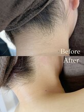 ルアーナ(LUANA)/後ろ美人セット