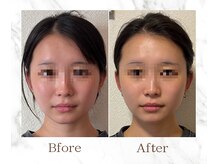 サワエギンザ(SAWAEGINZA)の雰囲気（睡眠美容♪心と身体を整え、お顔もスッキリと引き上げます！）