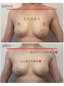 ブルーム(bluem)/左右差プチ解消！！