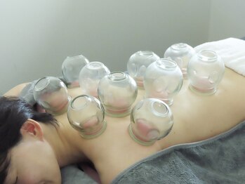 白記漢方堂鍼灸院(HAKU KI)/カッピング