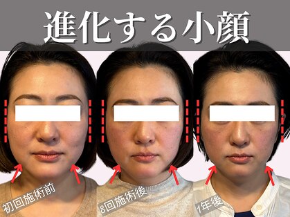 フレキシボディ(FlexiBody)の写真