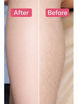 イニティウム 清澄白河(initium)/【脚WAXで清潔感アップ】