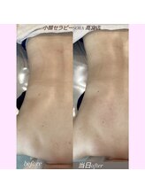 ソラ 高宮店(SORA)/背中コルギセラピー30分