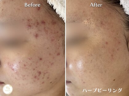 プリュボーテ 吉祥寺(Pul Beaute)の写真