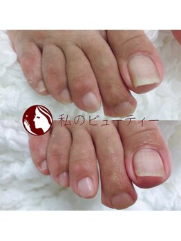 私のビューティー/フットケア
