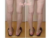 アンフィニ(infini)/下半身集中コース（2ヶ月)