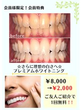 フタバ 天神大名店(futaba)/プレミアムホワイトニング会員割