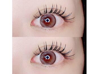 ウィンジュリー(Winjury)/パリエク