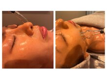 ポーラ 麻布十番駅前店(POLA)/：エステ