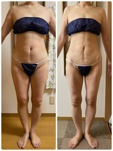 クレビア 吉祥寺店(CREBIA)/エンダモロジー/痩身/吉祥寺