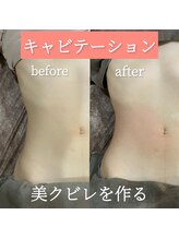 リラ 郡山店(Lilas)/キャビテーションで美クビレGET