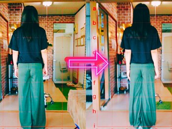 サプライズ整体院/20代ママの初回産後の骨盤矯正