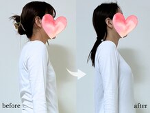 エーアール(AR)/【Before/After】4回目