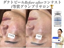 レシェルサロン(Lechelle Salon)の雰囲気（TVで紹介された大人気のサロン♪モデルタレントさん御用達サロン）