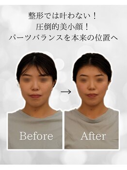 シナジェ 並木通り店(Synergye)/頭蓋骨から整える♪