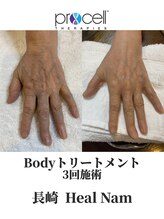 ヒルナム(Heal Nam)/プロセルセラピーズ~フェイス~