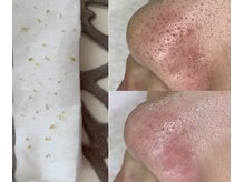 フルリール(Fleurir)