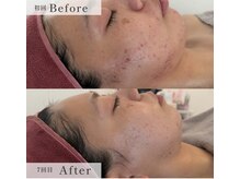 エム シャルール(M chaleur)