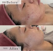 エム シャルール(M chaleur)