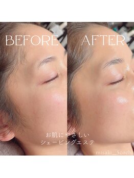 ゴコチ(5cochi)の写真/大人女性の隠れ家◎人目を気にせず静かに過ごせる完全個室で、お肌悩みにも寄り添う極上リラク体験を♪