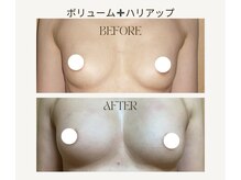 アップオー 小倉店(up・O)の雰囲気（新型のマシンを使用し、今までにないボリュームアップを実感！）