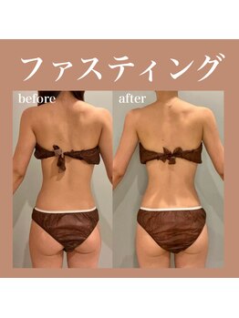 フラットベリー 恵比寿(Flat BELLY)/ファスティング