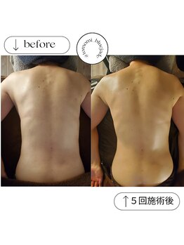 ブルー ジェイド(BLUE JADE)/筋膜リリース×５回