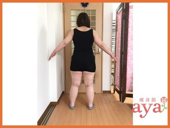 痩身館アヤ(aya)/耳つぼダイエット【富山/痩身】