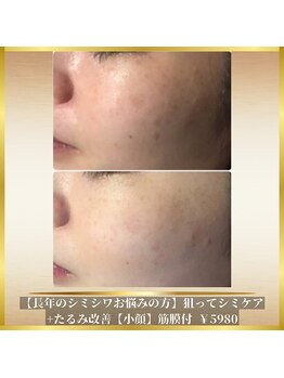 アイリープ(eyeleap)/☆【長年のシミシワお悩みの方】