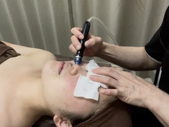 ミカシータ(micasita)の写真/【毛穴汚れゴッソリ】【肌質改善】お肌の状態に合わせて施術します◎美肌を手に入れ憧れのお肌へ♪