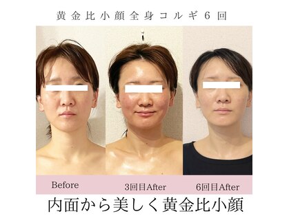 ピーチハート(Peach Heart)の写真