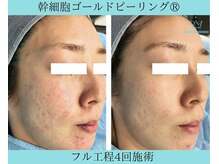 リメイク 広尾(REMAKE)/