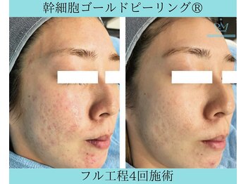 リメイク 広尾(REMAKE)/