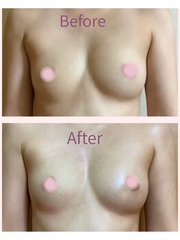 アップオー 小倉店(up・O)/体験者様　施術例