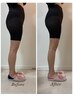 【2回目以降2週間以内】美尻・美脚継続★きゅんきゅんヒップ¥24000→¥15800