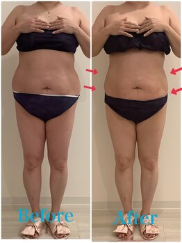 スペチアーレ 夙川/大人気の高額マシンばかり使う